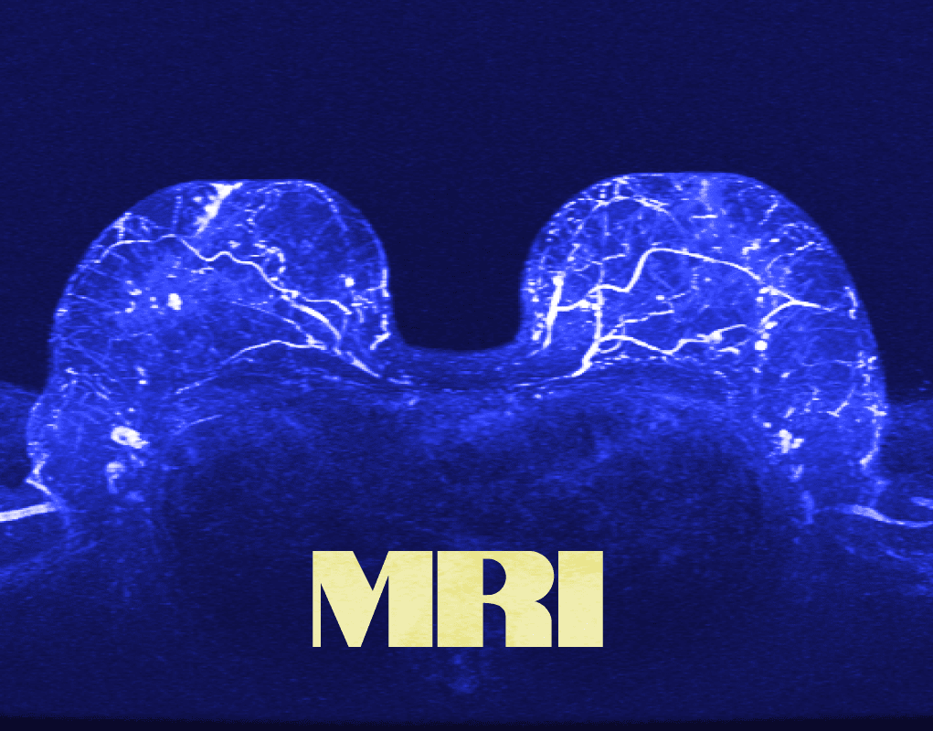 Breast MRI, prof. Uwe Fischer