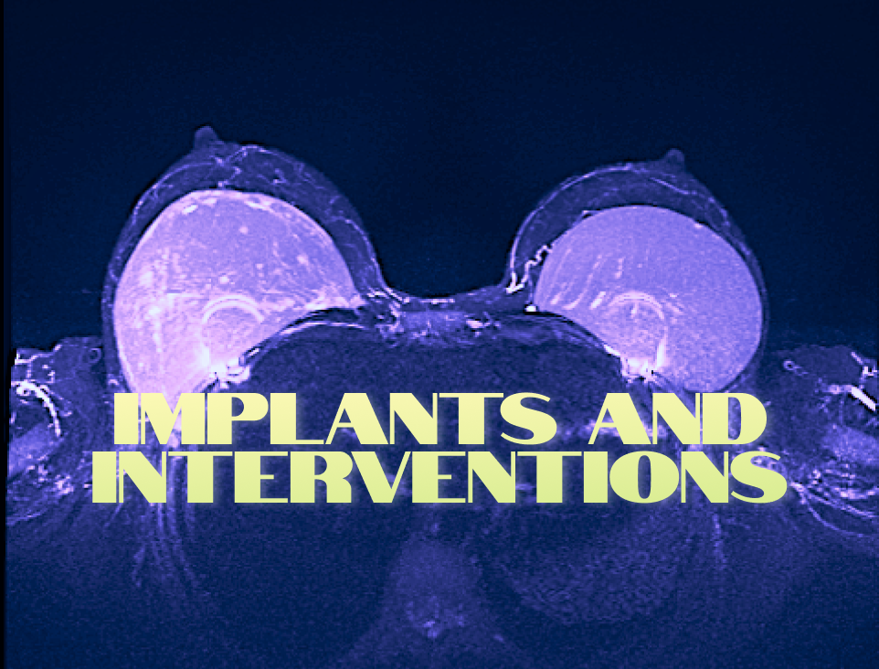 Breast Implants. MRI Interventions