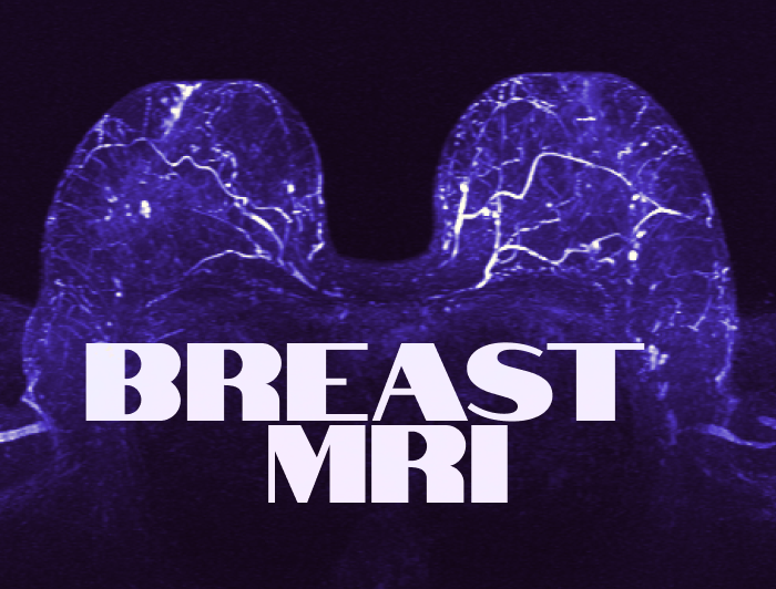 Breast MRI, prof. Uwe Fischer