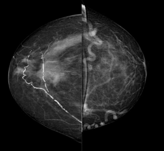 Introduction to Breast Imaging Vietnam