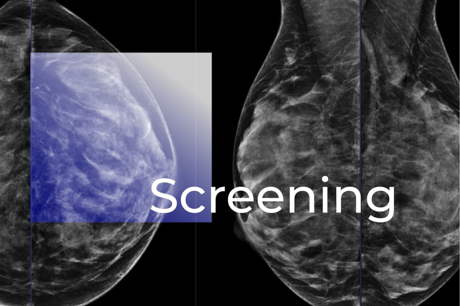 Breast Cancer Screening