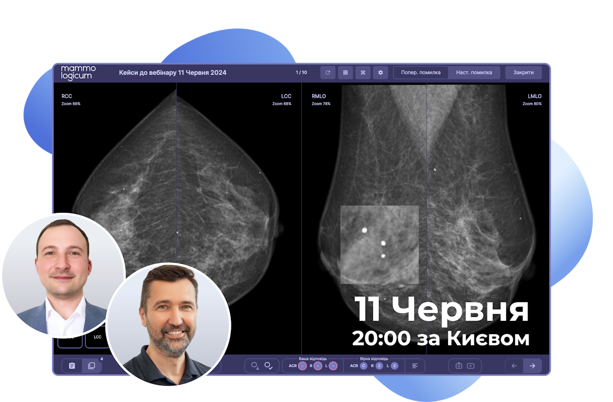 Отримай 30 хвилин знань про скринінг раку молочної залози, від експерта Андрія Гурандо з понад 10-річним стажем роботи в українській маморентгенографії. Протестуй свої навички у читанні мамограм у спеціальному переглядачі знімків. І розбери реальні клінічні кейси з німецьким мамморадіологом Сергієм Поповичем.