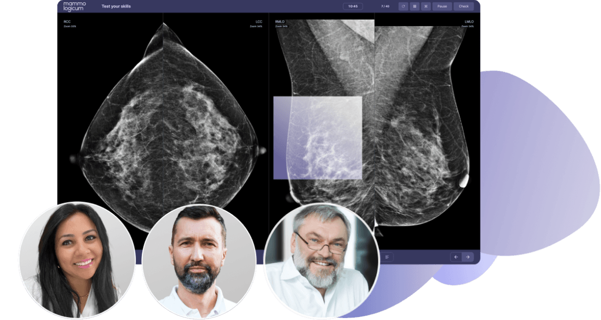 A free live webinar with international gurus in breast MRI and breast radiology, Prof. Uwe Fischer (Germany) and Dr. Norran Hussein (Egypt).

 The webinar is leading in partnership with the Egyptian Society of Women’s Health.

 ![](https://ngbigyscjvobzkbddrxx.supabase.co/storage/v1/object/public/static/ESWN-logo-187.png)