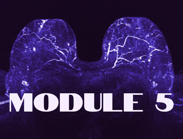 Malignant findings on an MRI