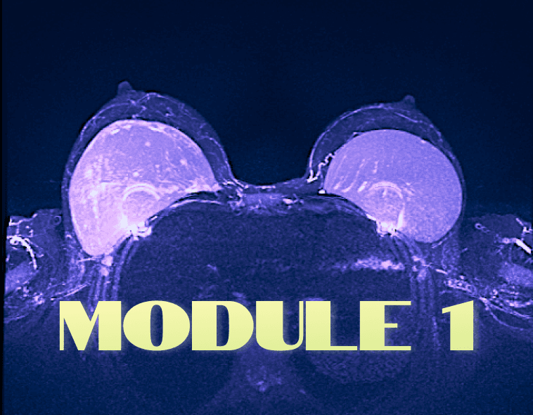 Features of diagnostics of implants and breast reconstructions