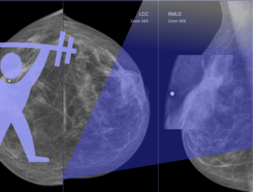 Тренажерный зал супермаммолога / Август