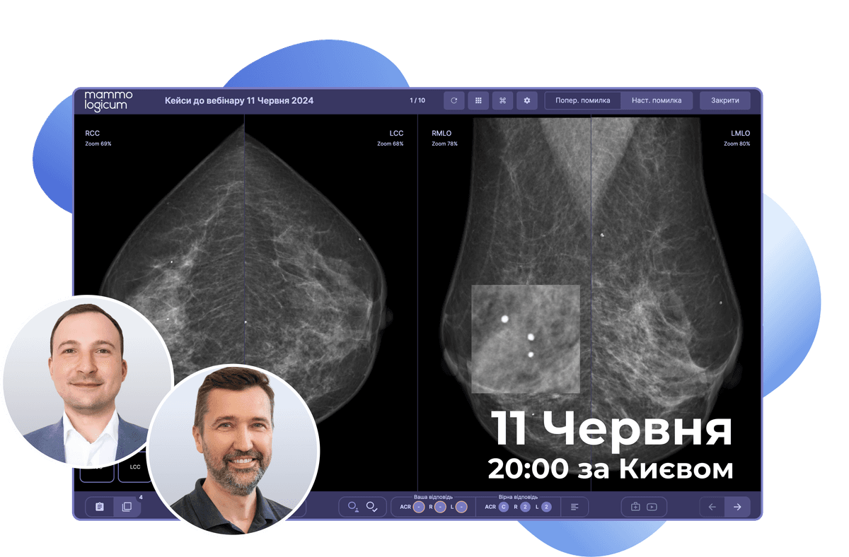 Отримай 30 хвилин знань про скринінг раку молочної залози, від експерта Андрія Гурандо з понад 10-річним стажем роботи в українській маморентгенографії. Протестуй свої навички у читанні мамограм у спеціальному переглядачі знімків. І розбери реальні клінічні кейси з німецьким мамморадіологом Сергієм Поповичем.